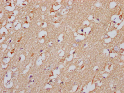 GABRA5 Recombinant Monoclonal Antibody