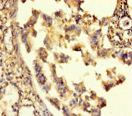 GABRA6 Antibody