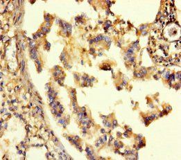 GABRA6 antibody