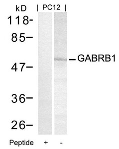 GABRB1 (Ab-434) Antibody
