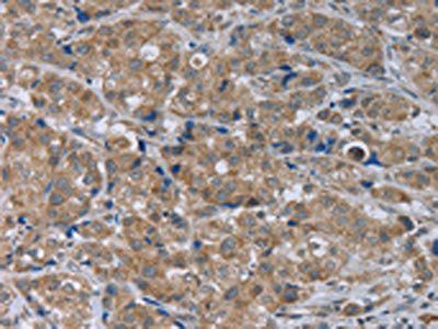 GABRB1 Antibody