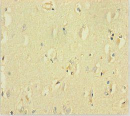 GABRQ Antibody
