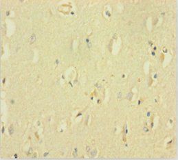 GABRQ antibody