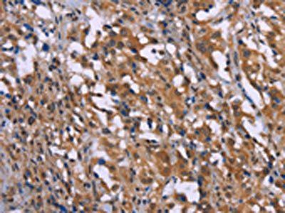 GAD1 Antibody