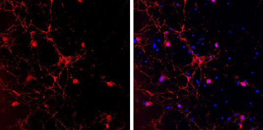 GAD65 antibody [C2C3], C-term