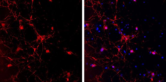 GAD65 antibody