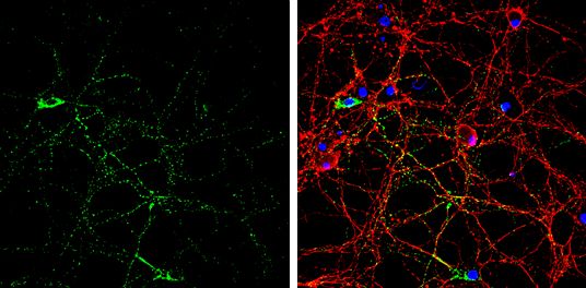 GAD65 antibody
