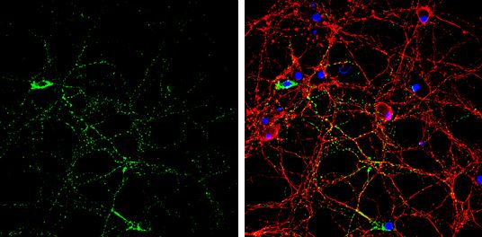 glutamate decarboxylase 2 Antibody