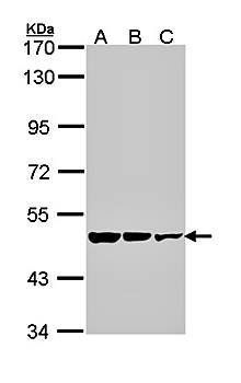 GAD65 antibody