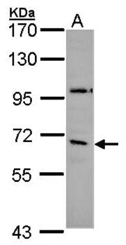 GAD65 antibody