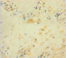 GADD45B Antibody