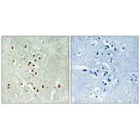 GADD45GIP1 antibody