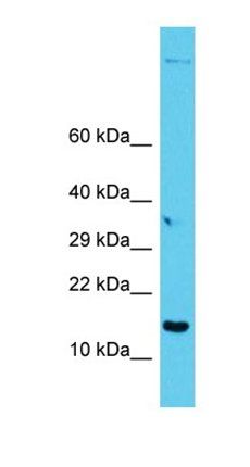 GAGE12I antibody