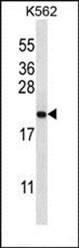 GAGE2B antibody