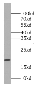 GAGE2D antibody