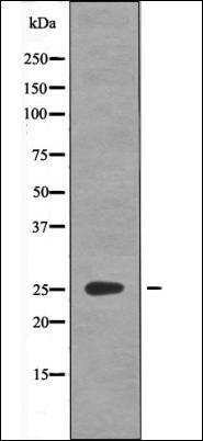GAIP (Phospho-Ser151) antibody
