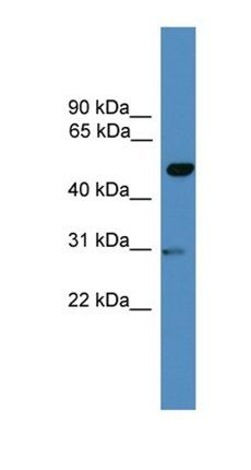 GAL3ST3 antibody