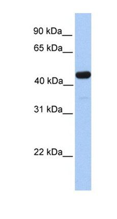 GAL3ST3 antibody