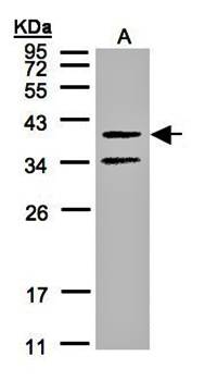 galanin receptor 2 antibody