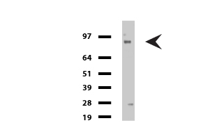 Galectin 1 (LGALS1) antibody