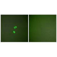 LGALS3 Antibody