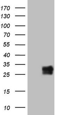 Galectin 3 (LGALS3) antibody