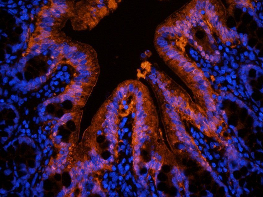 Galectin 3 antibody