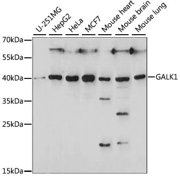 GALK1 antibody