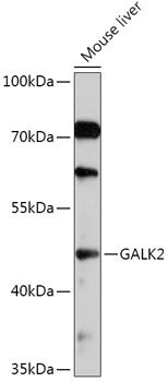 GALK2 antibody
