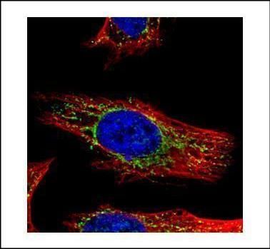 galactosamine (N-acetyl)-6-sulfatase Antibody