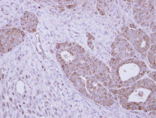 GALNS Rabbit Polyclonal Antibody