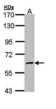 GALNS antibody