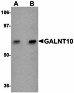 GALNT10 Antibody