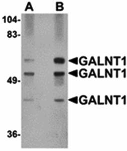 GALNT10 Antibody