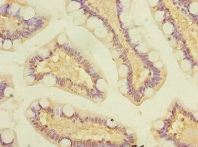 GALNT12 Antibody