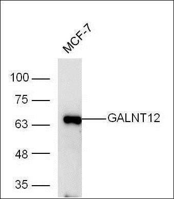 GALNT12 antibody