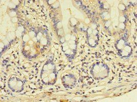 GALNT14 Antibody