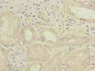 GALNT15 Antibody