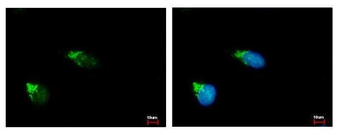 GALNT2 antibody