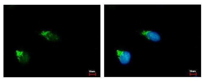 polypeptide N-acetylgalactosaminyltransferase 2 Antibody