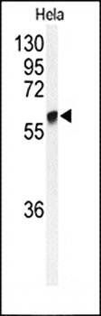 GALNT2 antibody