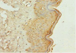 GALNT3 Antibody