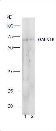 GALNT6 antibody
