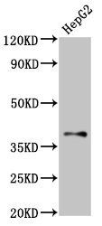 GALR1 antibody