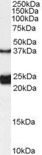 Goat anti-GALR1 (internal) Antibody