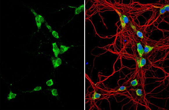 GALR2 antibody [C1C2], Internal