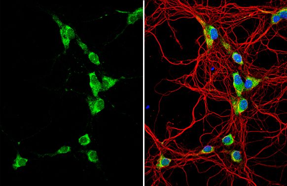 GALR2 antibody