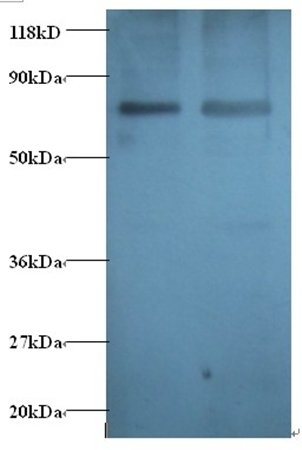 Gamma-aminobutyric acid R-associated protein antibody (Biotin)