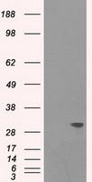 gamma Catenin (JUP) antibody