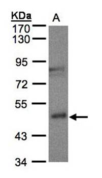 Gamma-butyrobetaine dioxygenase antibody